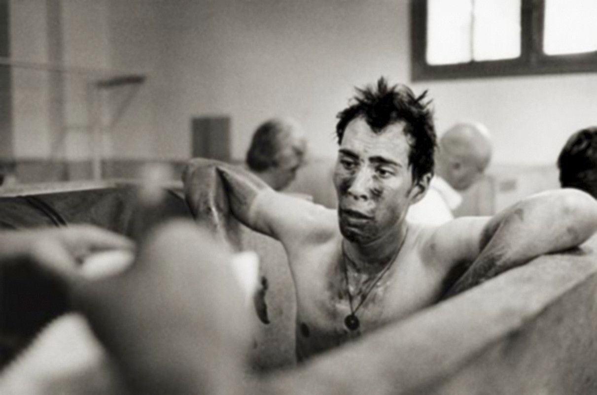 Pedro Horrillo, erabat lehertuta, Roubaixeko belodromoko dutxetan. BERRIA. Pedro Horrillo, erabat lehertuta, Roubaixeko belodromoko dutxetan. BERRIA.