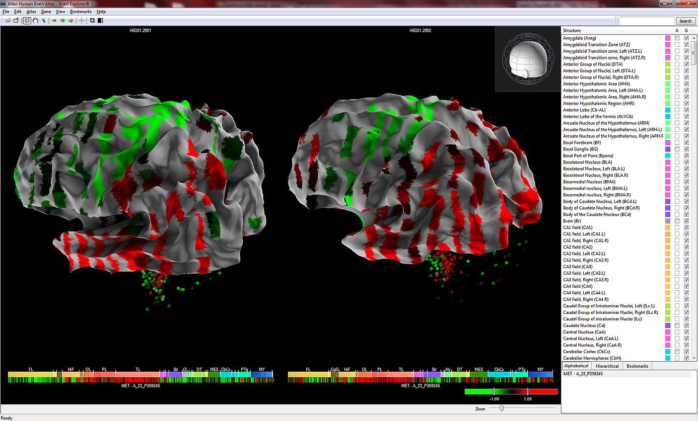 Garunaren barne egituretako gene baten espresioa. ALLEN INSTITUTE FOR BRAIN SCIENCE. Garunaren barne egituretako gene baten espresioa. ALLEN INSTITUTE FOR BRAIN SCIENCE.