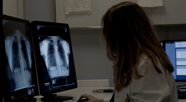 Mediku bat, erradiografia bati begira. BERRIA