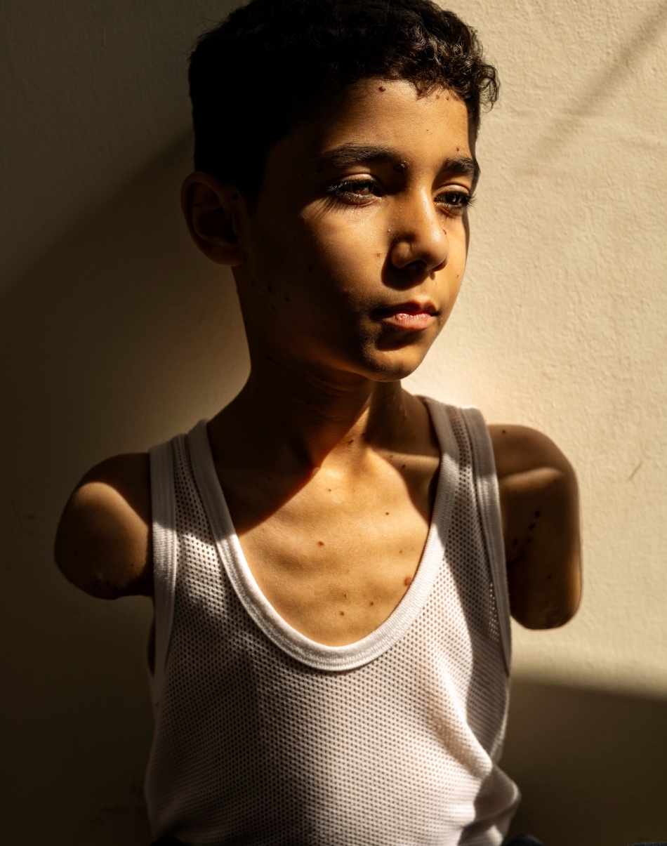 World Press Photo-ren argazki irabazlea. SAMAR ABU ELOUF / EFE